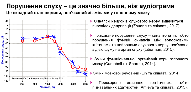 Порушення слуху